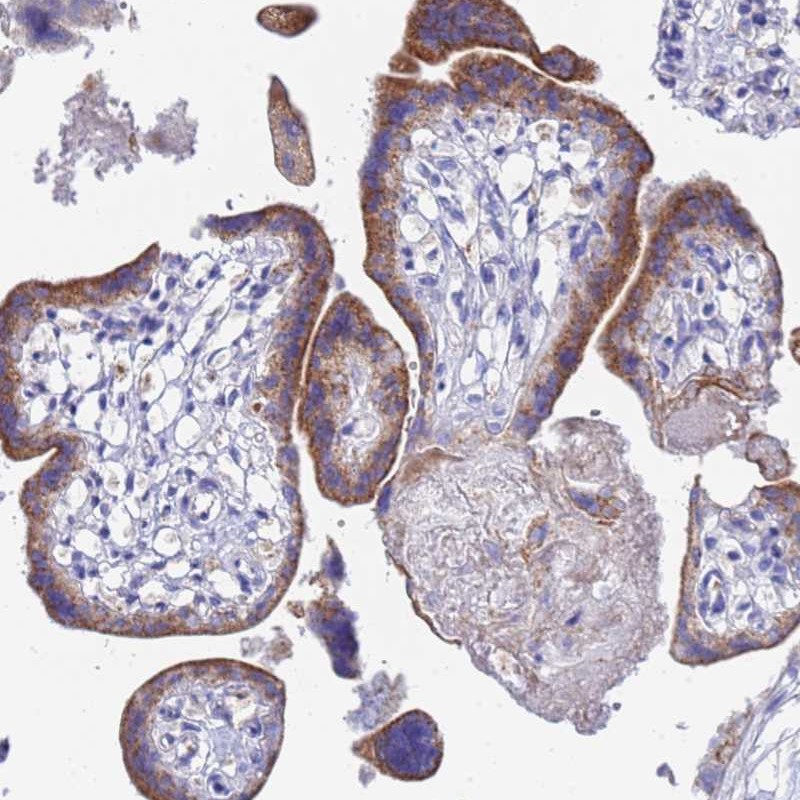 Anti-ZNF26 Antibody
