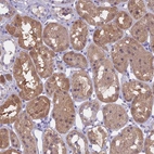 Anti-LHFPL2 Antibody
