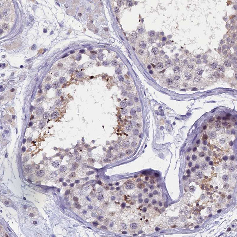 Anti-KIAA1683 Antibody