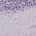Immunohistochemical staining of human cerebellum shows strong nuclear positivity in Purkinje cells.