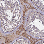 Anti-CLRN2 Antibody