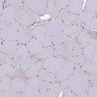Immunohistochemical staining of human skeletal muscle shows negative no positivity in myocytes as expected.
