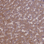 Immunohistochemical staining of human liver shows moderate cytoplasmic positivity in hepatocytes.