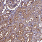 Immunohistochemical staining of human kidney shows moderate cytoplasmic positivity in cells in tubules.