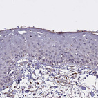 Immunohistochemical staining of human skin shows no positivity in squamous epithelial cells as expected.