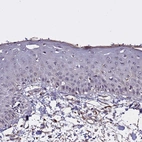 Immunohistochemical staining of human skin shows no positivity in squamous epithelial cells as expected.