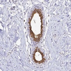 Anti-CIB1 Antibody