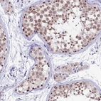 Immunohistochemical staining of human testis shows high expression.
