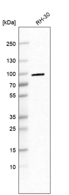 Western blot analysis in human cell line RH-30.