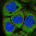 Immunofluorescent staining of human cell line A-431 shows localization to nucleoplasm & cytosol.