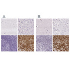 Anti-PRL Antibody