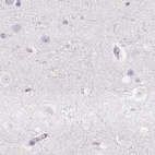 Immunohistochemical staining of human cerebral cortex using Anti-PRL antibody HPA042416.