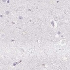 Anti-PRL Antibody