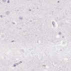 Immunohistochemical staining of human cerebral cortex using Anti-PRL antibody HPA042416.