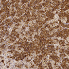 Anti-PRL Antibody