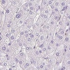 Anti-PRL Antibody