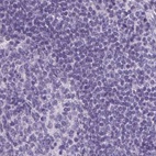 Immunohistochemical staining of human lymph node using Anti-PRL antibody HPA042416.