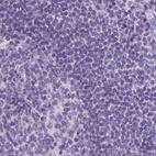 Anti-PRL Antibody