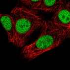 Anti-SNRPC Antibody