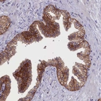 Anti-COL19A1 Antibody
