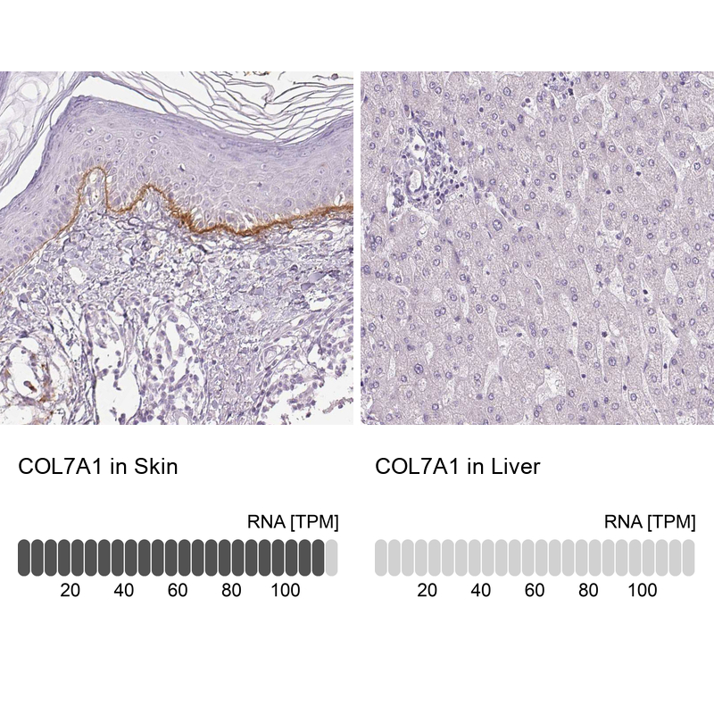 Anti-COL7A1 Antibody