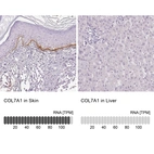 Anti-COL7A1 Antibody