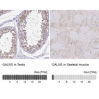 Anti-GALNS Antibody