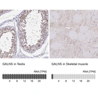 Anti-GALNS Antibody