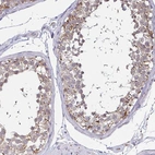 Immunohistochemical staining of human testis shows high expression.