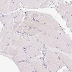 Immunohistochemical staining of human skeletal muscle shows no positivity in myocytes as expected.