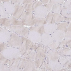 Immunohistochemical staining of human skeletal muscle shows low expression as expected.