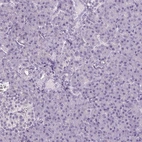 Immunohistochemical staining of human pancreas shows no positivity in exocrine glandular cells as expected.