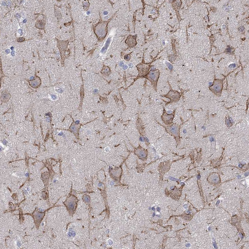 Anti-KCNB1 Antibody