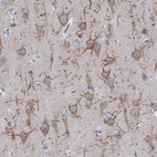 Anti-KCNB1 Antibody