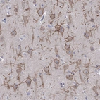 Anti-KCNB1 Antibody