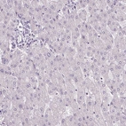 Immunohistochemical staining of human liver shows no positivity in hepatocytes as expected.