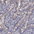 Immunohistochemical staining of human small intestine shows moderate membranous positivity in glandular cells.