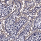 Immunohistochemical staining of human small intestine shows moderate membranous positivity in glandular cells.