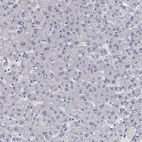 Immunohistochemical staining of human liver shows no positivity in hepatocytes as expected.