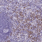 Anti-IL17B Antibody
