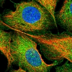 Immunofluorescent staining of human cell line U-2 OS shows localization to plasma membrane & cytosol.