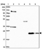 Lane 1: Marker [kDa] 250, 130, 95, 72, 55, 36, 28, 17, 10_br/_Lane 2: Human cell line RT-4_br/_Lane 3: Human cell line U-251MG sp_br/_Lane 4: Human plasma (IgG/HSA depleted)_br/_Lane 5: Human liver tissue_br/_Lane 6: Human tonsil tissue