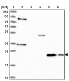 Lane 1: Marker [kDa] 250, 130, 95, 72, 55, 36, 28, 17, 10_br/_Lane 2: Human cell line RT-4_br/_Lane 3: Human cell line U-251MG sp_br/_Lane 4: Human plasma (IgG/HSA depleted)_br/_Lane 5: Human liver tissue_br/_Lane 6: Human tonsil tissue