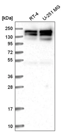 Anti-SYMPK Antibody