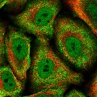 Immunofluorescent staining of human cell line A549 shows localization to nucleoplasm & cytosol.