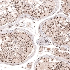 Immunohistochemical staining of human testis shows moderate nuclear positivity in cells in seminiferous ducts.