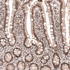Immunohistochemical staining of human small intestine shows strong nuclear positivity in glandular cells.