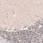 Immunohistochemical staining of human cerebellum shows moderate nuclear positivity in Purkinje cells as well as in cells in molecular layer.