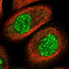 Immunofluorescent staining of human cell line A-431 shows localization to nuclear speckles & cytosol.