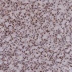 Anti-SH3D21 Antibody